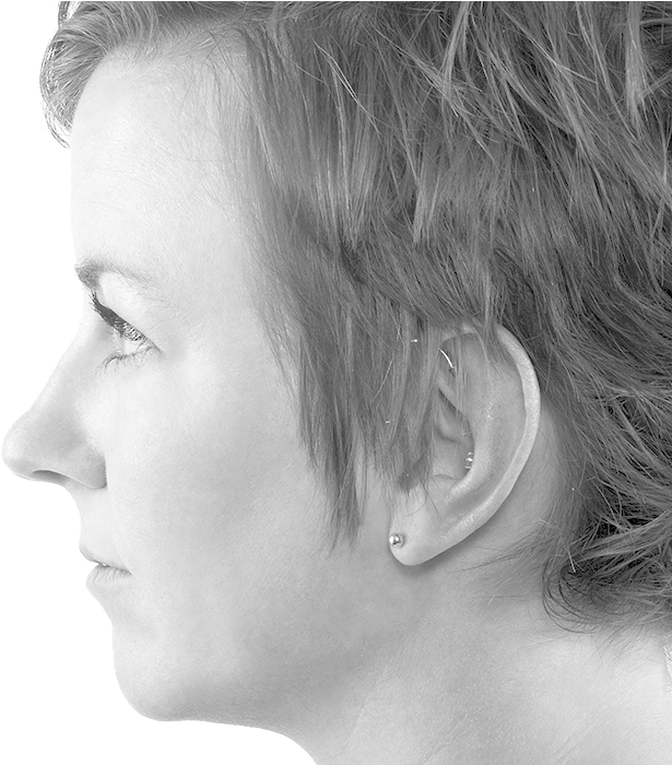 Microlaserpeel - Girl (656x699), Png Download