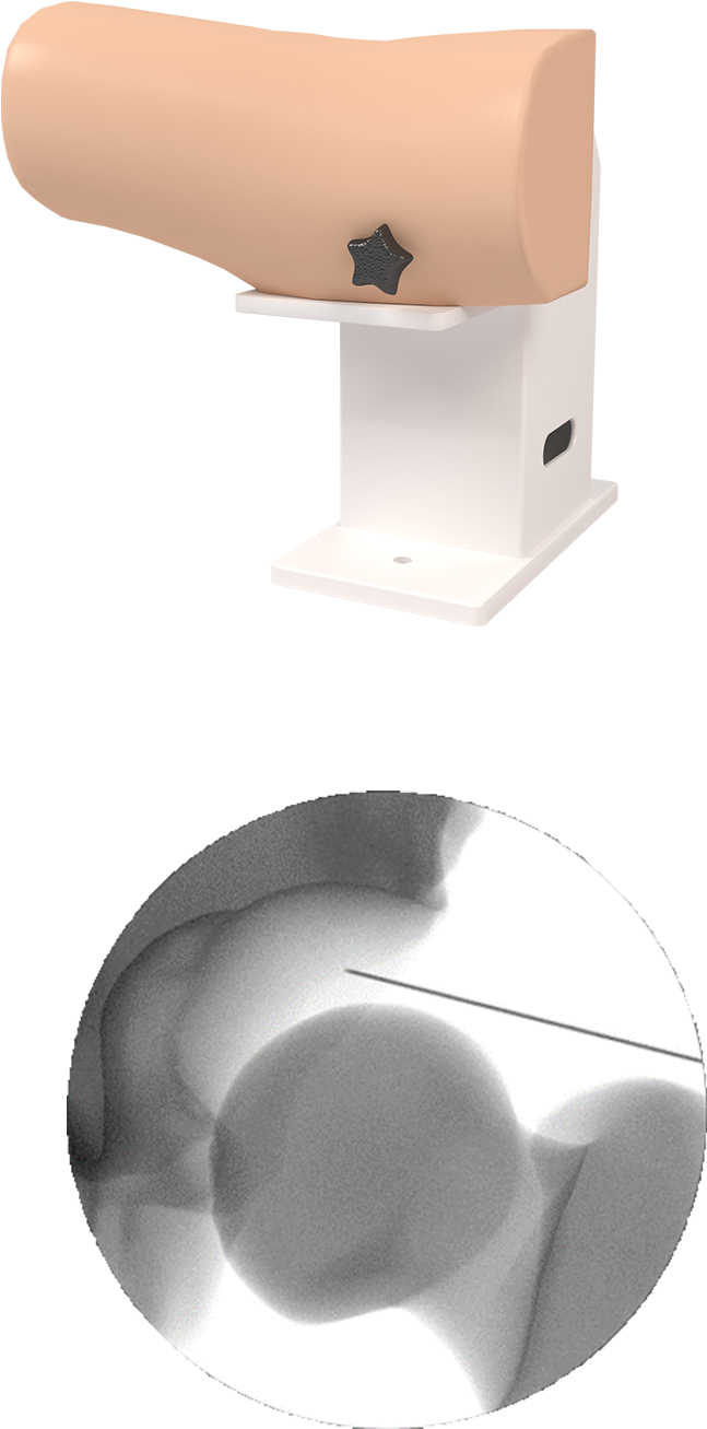 Read About The Virtamed Arthros™ Hip Release - Kitchen Scale (772x1500), Png Download