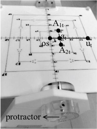 The "isocentric Beam Checker" Device And The Points - Luxury Yacht (850x431), Png Download