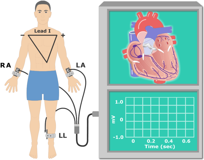 The P Wave Ekg Recording Animation Slide - Electrocardiography (666x550), Png Download