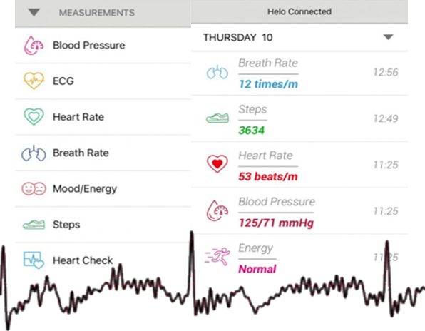 Helo Ekg Testing - Helo Ekg (596x464), Png Download