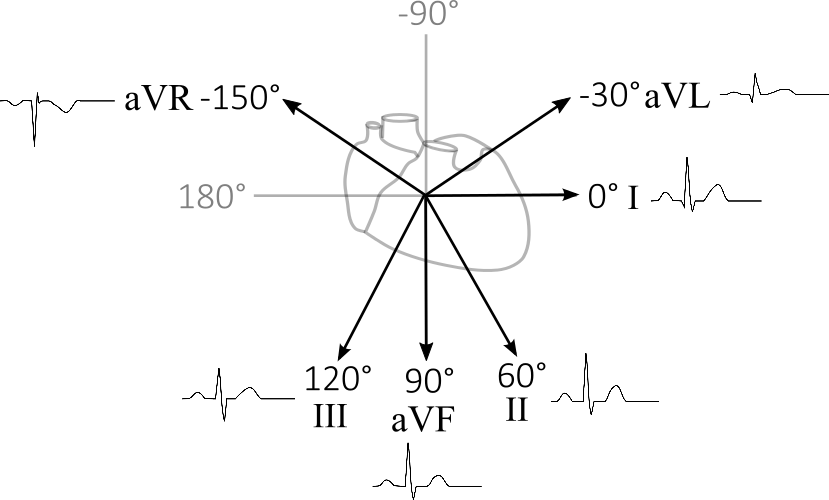 Cardiac Vector Ekg Jpg Black And White Download - Diagram (829x500), Png Download