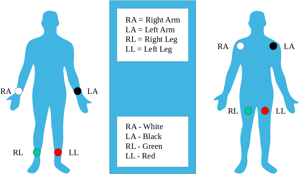 The 12-lead Ecg Electrode Placement Is Essential For - Modified Limb Lead Placement (1024x683), Png Download