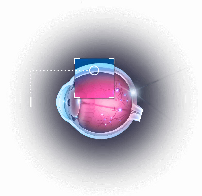 Eye - Suprachoroidal Cls Ta (831x805), Png Download
