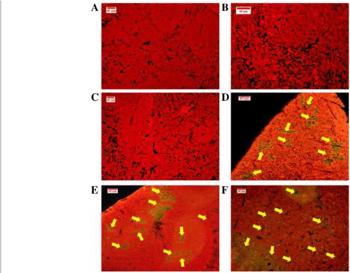 Tunel Assay Used To Detect The Apoptotic Cells In Spleen - Common Fig (850x533), Png Download