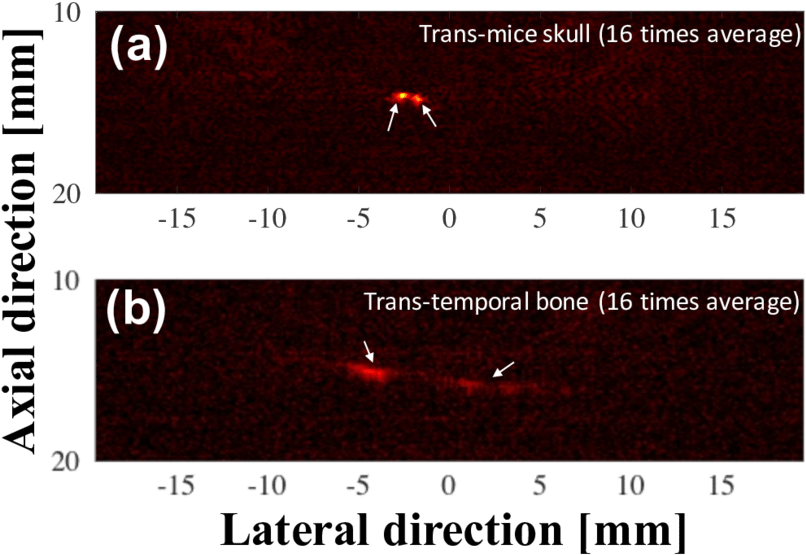 Preliminary Ex Vivo Photoacoustic Imaging Results For - Photoacoustic Imaging (850x594), Png Download