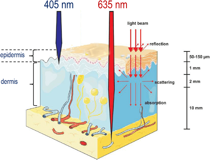 The Principle Of Photodynamic Therapy And Commonly - Penetration In Red Light (767x579), Png Download