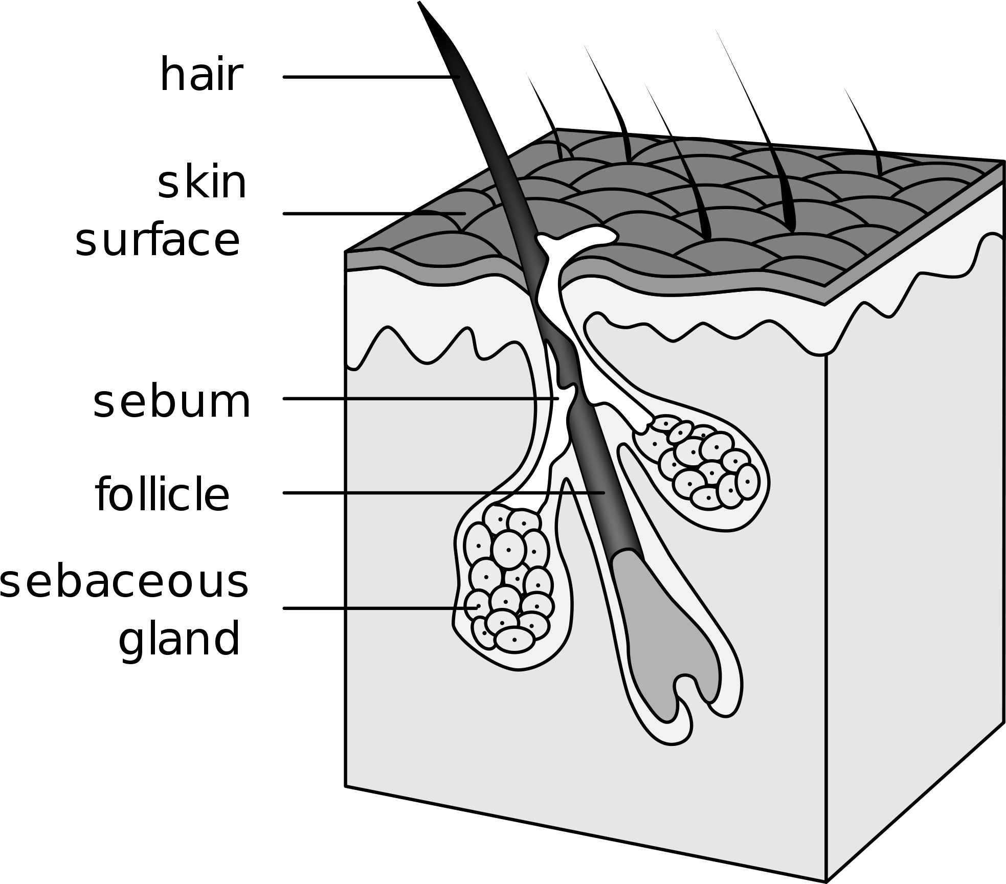 Hair Transplant (2000x1729), Png Download