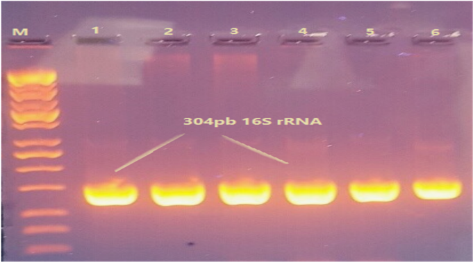 Agarose Gel Electrophoresis Of Amplified 16 Srrna Gene - Agarose Gel 16s (909x383), Png Download
