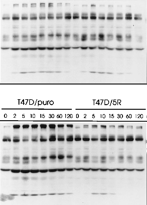 Total Phosphotyrosine Blot Of Egf And Ndf Induced T47d/puro - Monochrome (477x665), Png Download