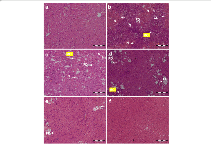 Effect Of C - Histopathology (850x581), Png Download