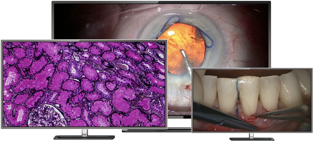 Large 4k Uhd Monitors For Displaying Pathology, Ophthalmology, - Led-backlit Lcd Display (1100x481), Png Download