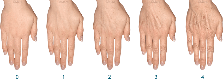 How Do You Rate Your Hands - Hands Filler (960x342), Png Download