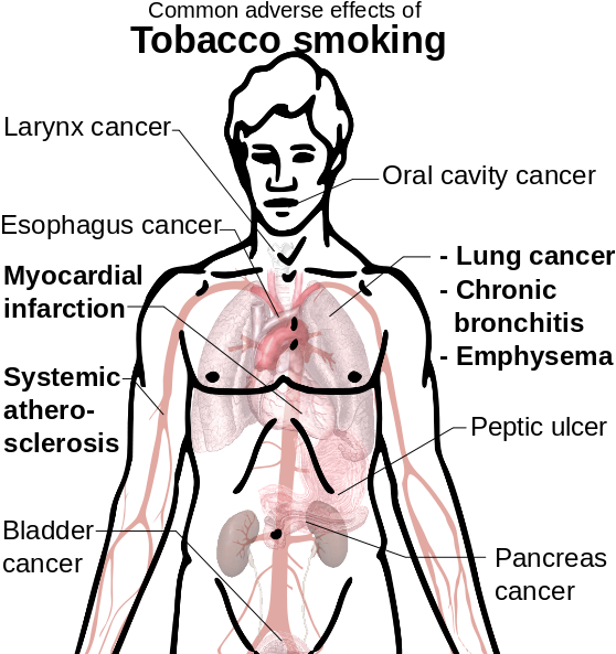 Drawn Cigarette Effect Tobacco (570x599), Png Download