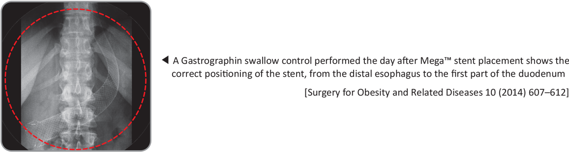 C-8[1] - Computed Tomography (1280x720), Png Download