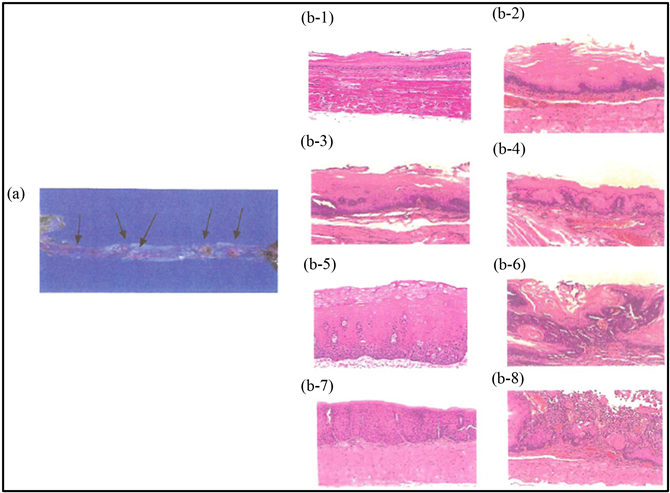 Various Pathological Lesions Induced By Nmba In A Rat - Dysplasia (903x497), Png Download
