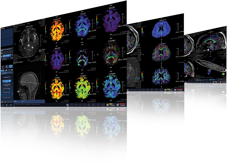 M-power Technology - Magnetic Resonance Imaging (800x630), Png Download