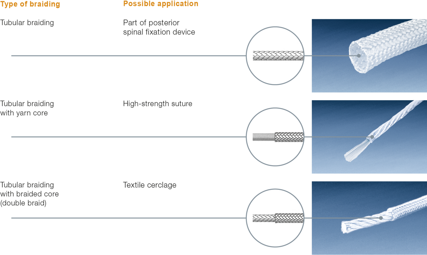 Type Of Braiding - Portable Network Graphics (1400x843), Png Download
