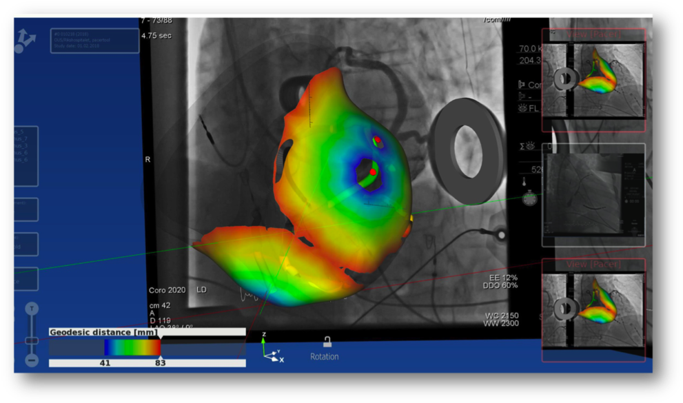 Turning The Bags Of Numbers Coming From Measurements - Portable Network Graphics (1000x594), Png Download