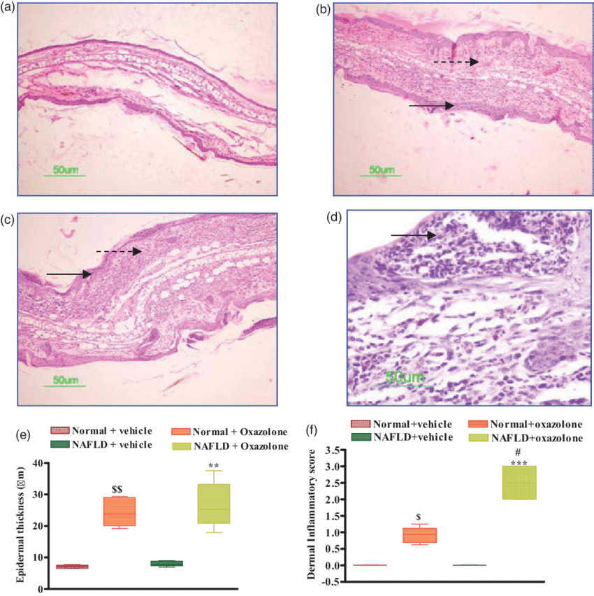 Effect Of Oxazolone On Ear Histopathology In Normal - Mouse Ear Inflammation Histo (850x852), Png Download