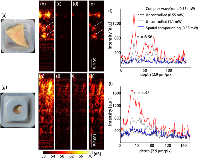 In Vitro Ws Oct Images Of The Chicken Breast And Mouse - Portable Network Graphics (850x679), Png Download