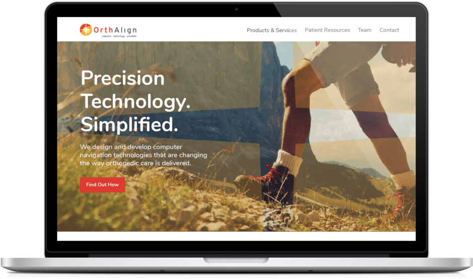 Knee Surgery Gets A Facelift - Apple Macbook Pro (1000x611), Png Download