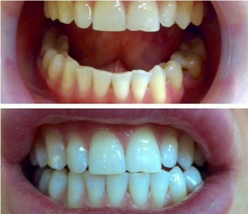 Everyone Feels Better When They Have Great Looking - Tongue (820x420), Png Download