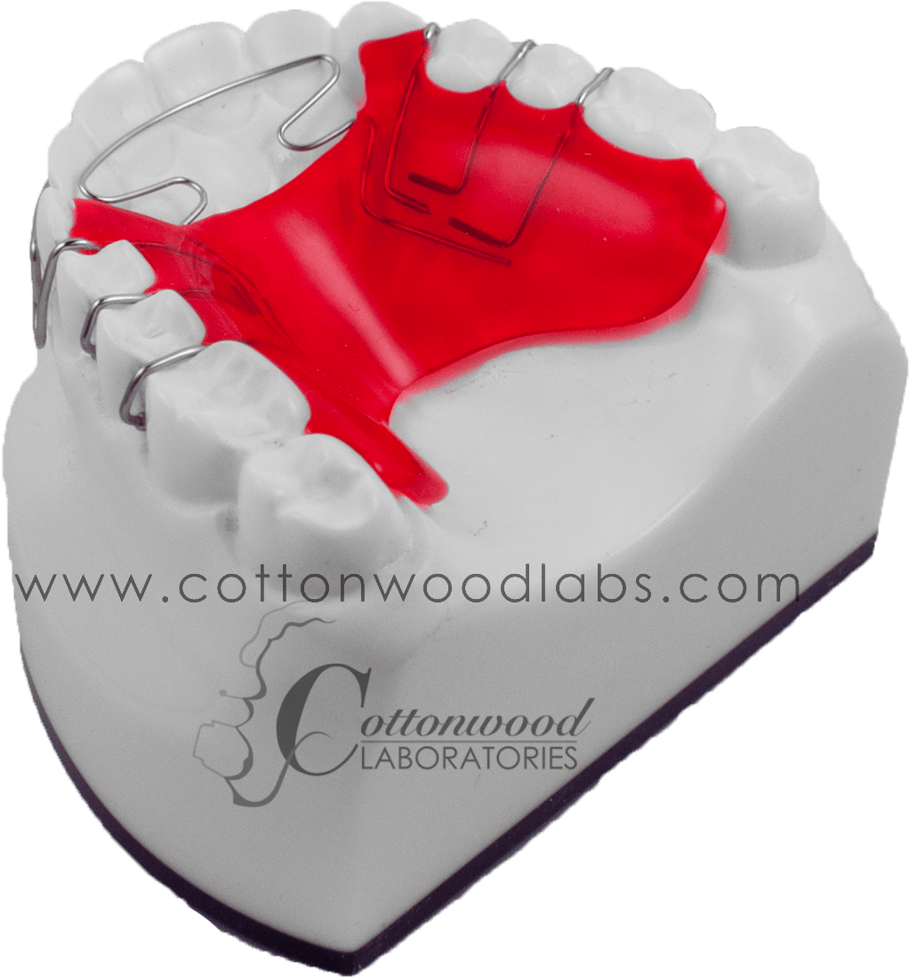 More Control Over Anterior Wire That Contacts The Teeth, - Birthday Cake (2000x1200), Png Download