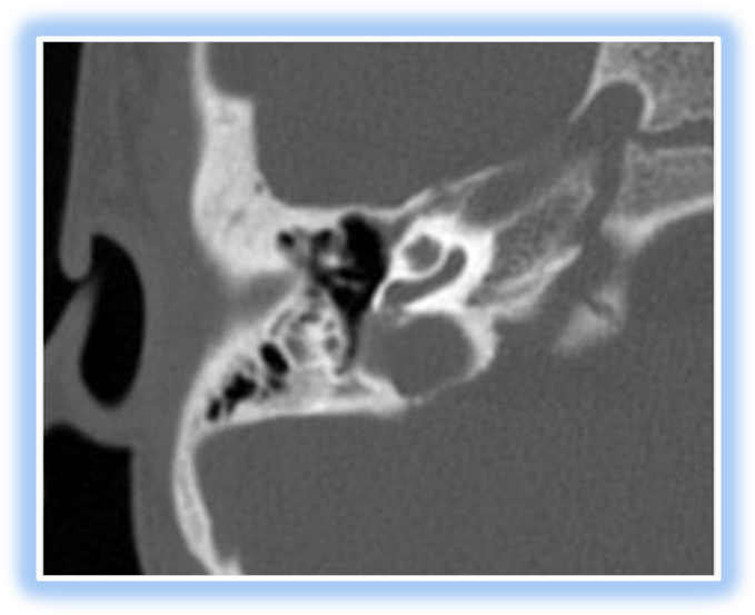 Slide0018 Image089 04 Nov 2009 - X-ray (693x567), Png Download