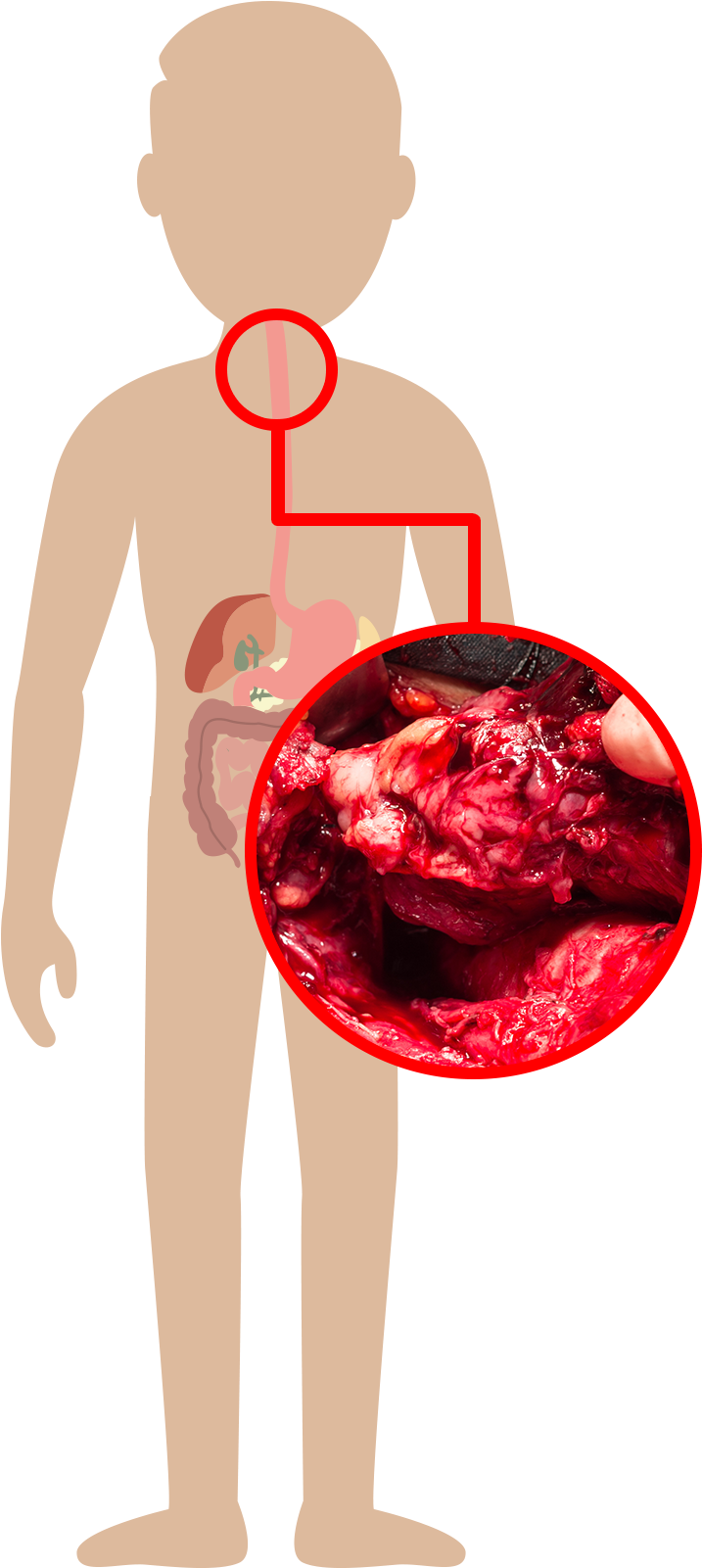 Mouth - Illustration (1000x1600), Png Download