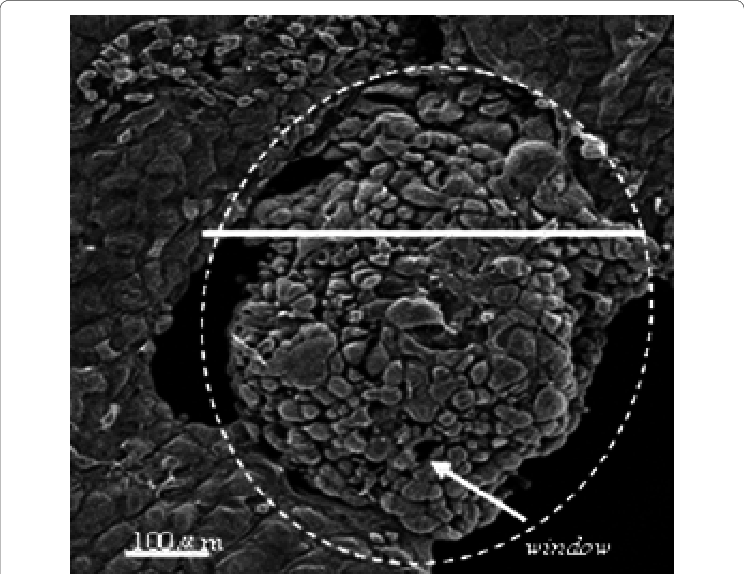 Omental Milky Spot On Greater Omentum Observed By Sem - Greater Omentum (744x574), Png Download