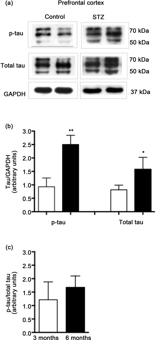 Stz Effect On P-tau In Prefrontal Cortex (903x1167), Png Download