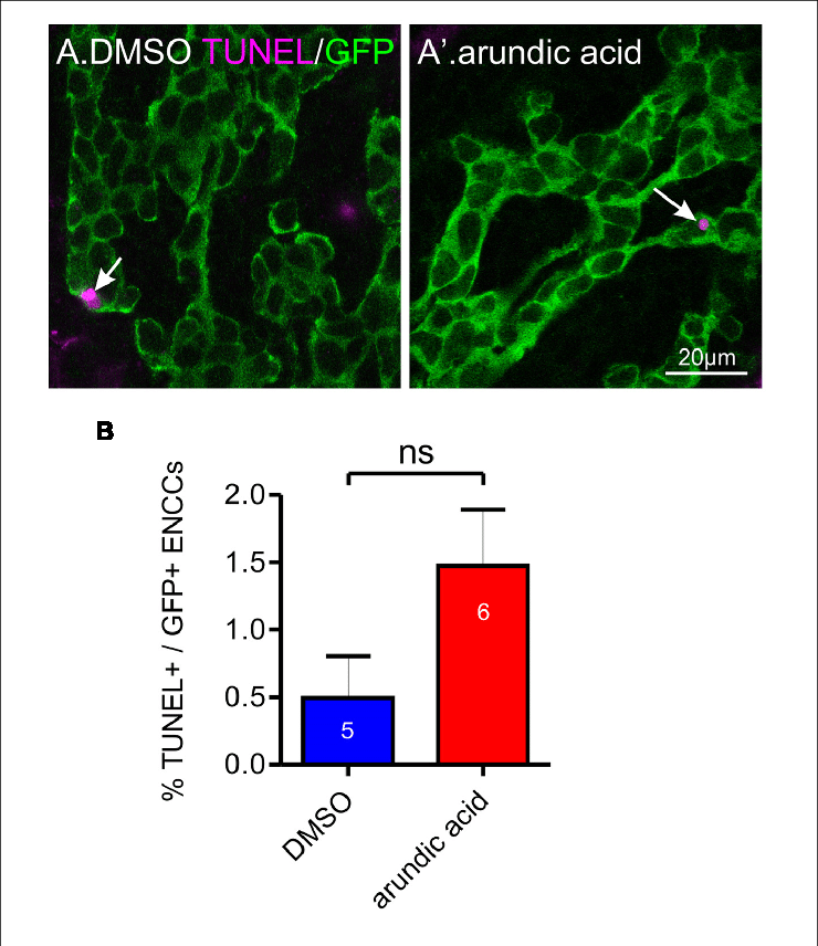 Effect Of Arundic Acid On Encc Cell Death In E13 - .org (740x856), Png Download