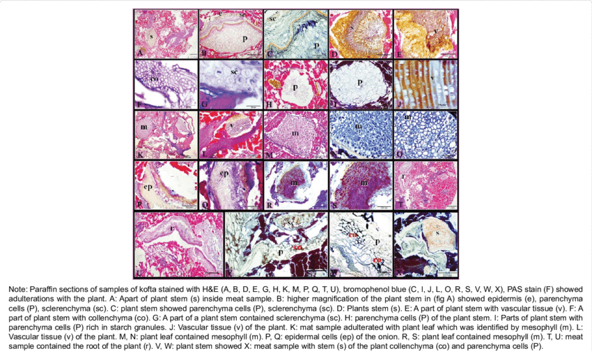 Adulterations Of Hawawshi Samples With Plant Tissues - Tissue (850x504), Png Download