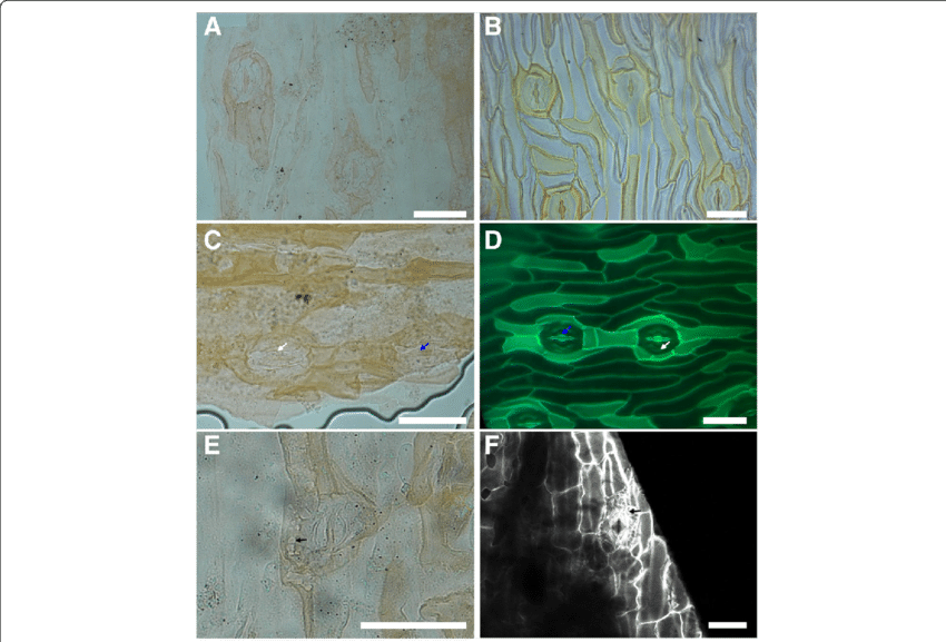 Comparison Between The Cuticle Of Eobowenia Incrassata - Pavement Cells (850x577), Png Download