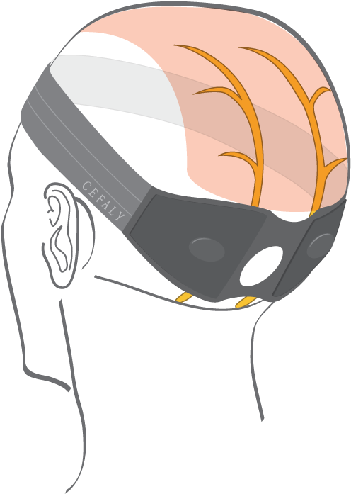 Occipital Neuralgia (600x714), Png Download