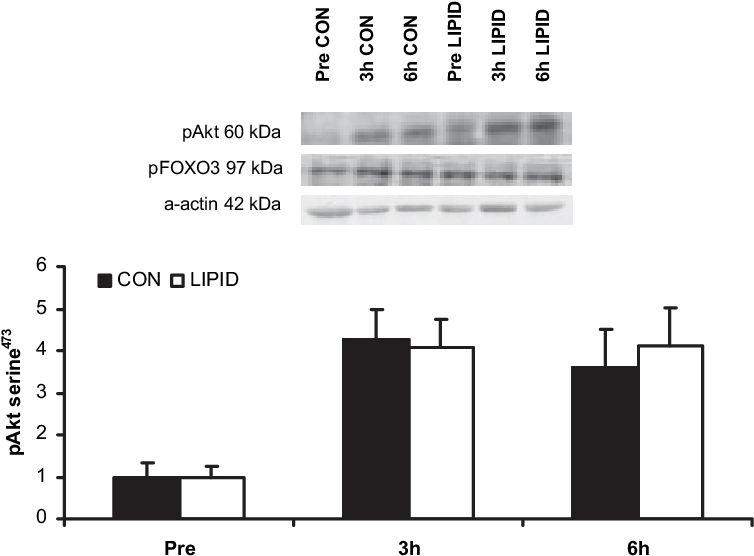 Skeletal Muscle Akt Serine 473 Phosphorylation During (754x562), Png Download