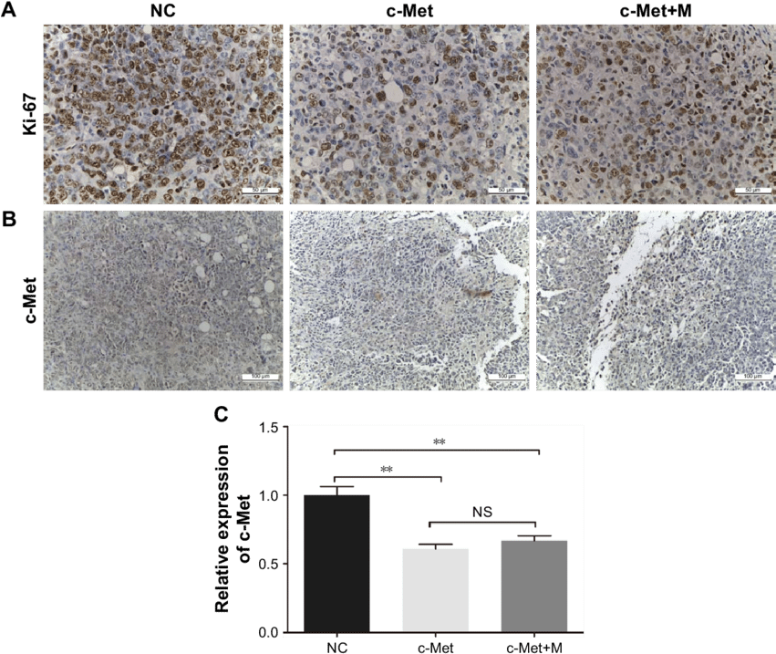 Histological Examination Of Ki (850x723), Png Download
