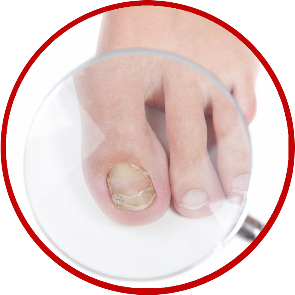 Fungus Png (1000x981), Png Download