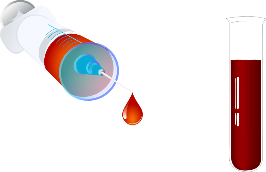Blood Test Tube Png Clipart Blood Test Test Tubes Clip - Blood Test Tube Png (900x581), Png Download
