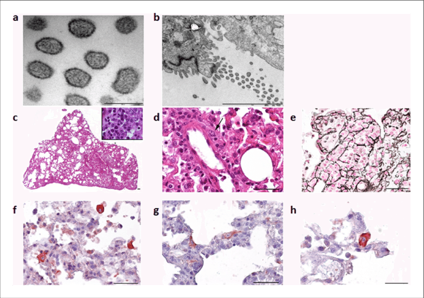 Electron Microscope Images Of The Cardamones Variant (850x598), Png Download