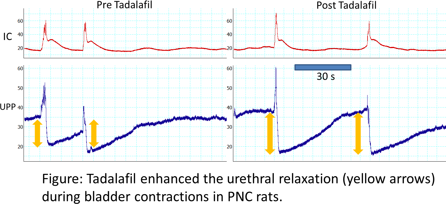 Source Of Funding (1535x737), Png Download