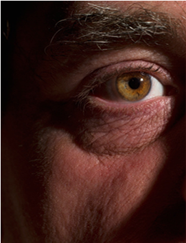 Dry Eyes - Close-up (1000x354), Png Download