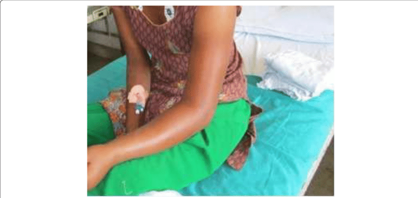 Patient At The Emergency Department With A Swollen, (850x402), Png Download