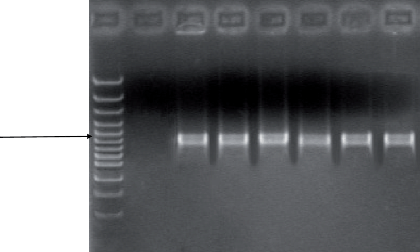 Detection Of X (850x511), Png Download