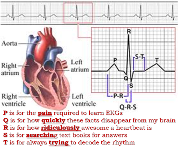 24hr Holter Monitor - 12 Lead Ekg: The Flash Card Book [book] (738x600), Png Download