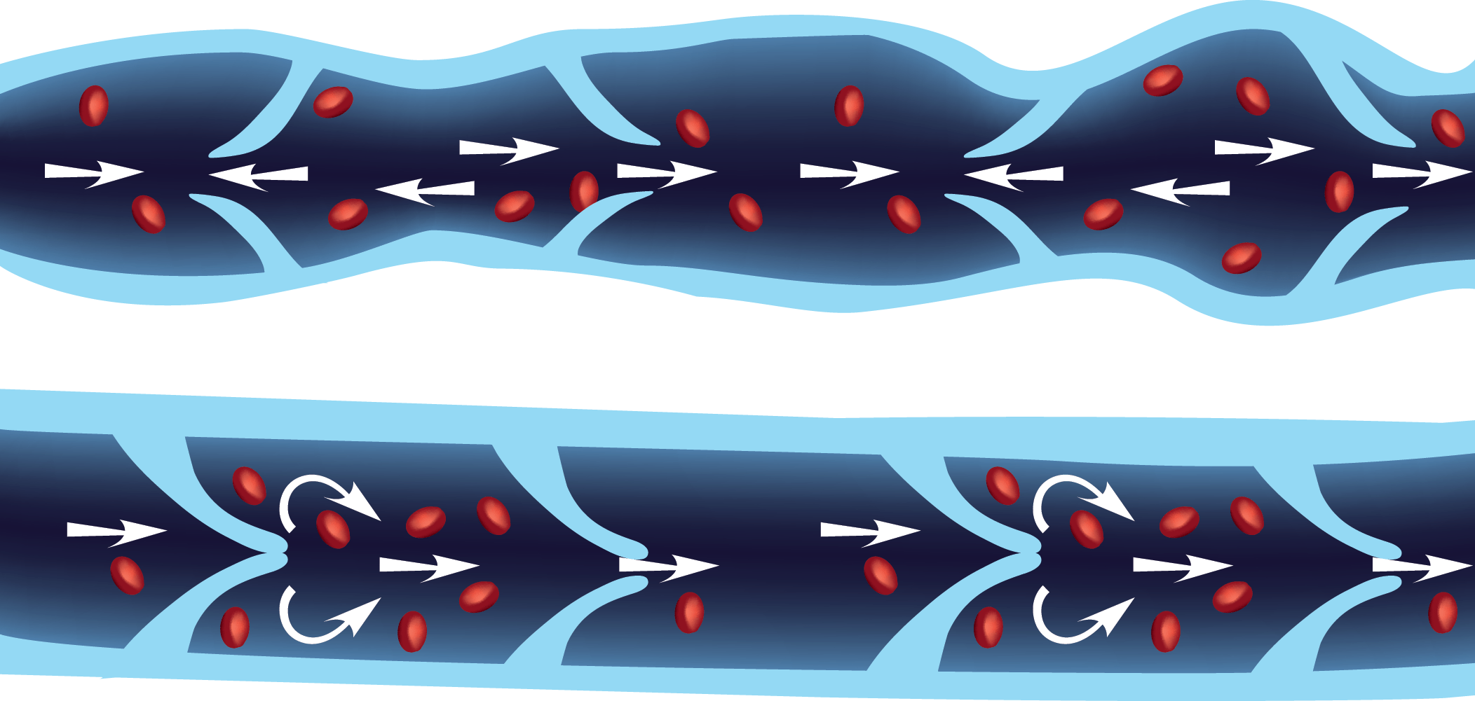 Varicose Veins By A Different Name - Vein (2104x1001), Png Download