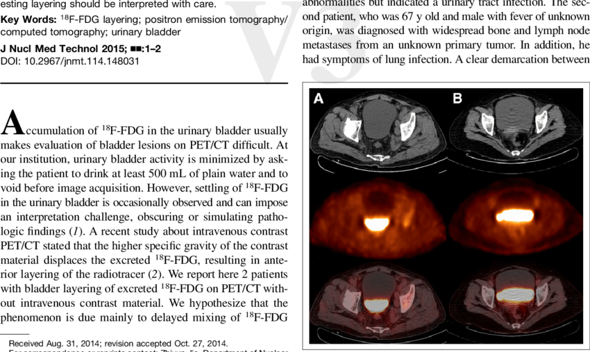 Ct , Pet (middle), And Pet/ct (bottom) Images Showing (850x507), Png Download