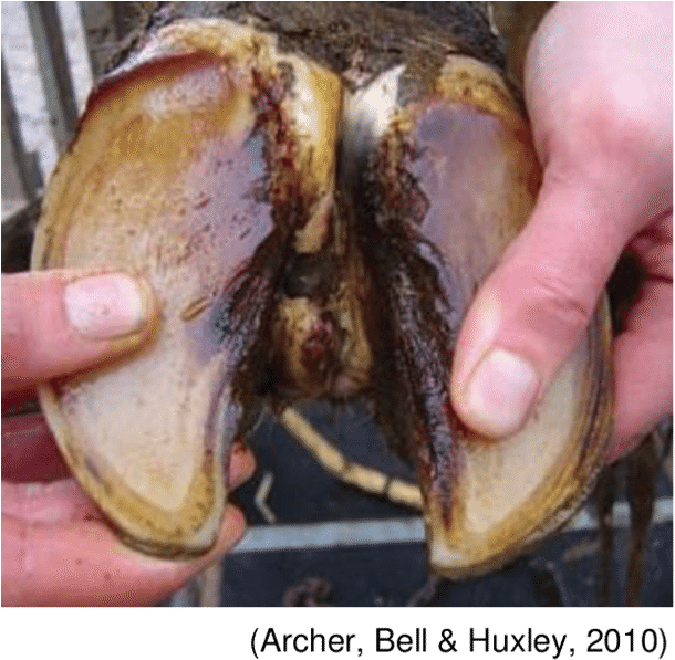 An Acute Bacterial Infection Of The Subcutaneous Tissues (850x615), Png Download