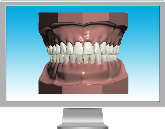 Digital Model Screen (722x550), Png Download